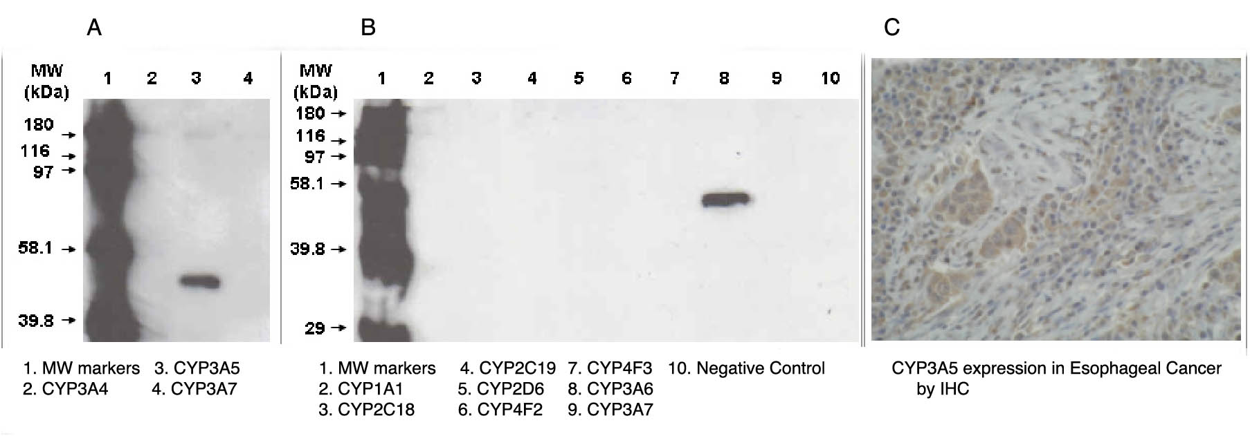 "A. and B. Western blot using 3A5 antibody (Cat. No. X2047M) on recombinant CYP450 proteins.
C. Immunohistochemistry stain using 3A5 antibody on oesophagus cancer tissue."